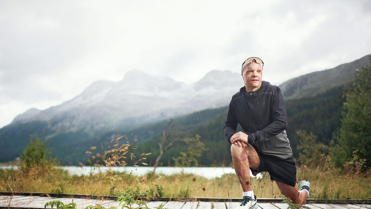 Schwerste Verbrennungen nach Arbeitsunfall