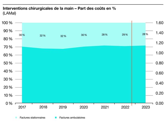 S100672_Grafiken_f_13 Handchirurgische Eingriffe – Anteil Kosten in % KVG.jpg