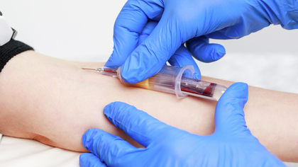 Mit Biomonitoring Gefahrstoffe im Körper erkennen