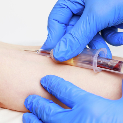 Détecter les substances dangereuses avec le monitoring