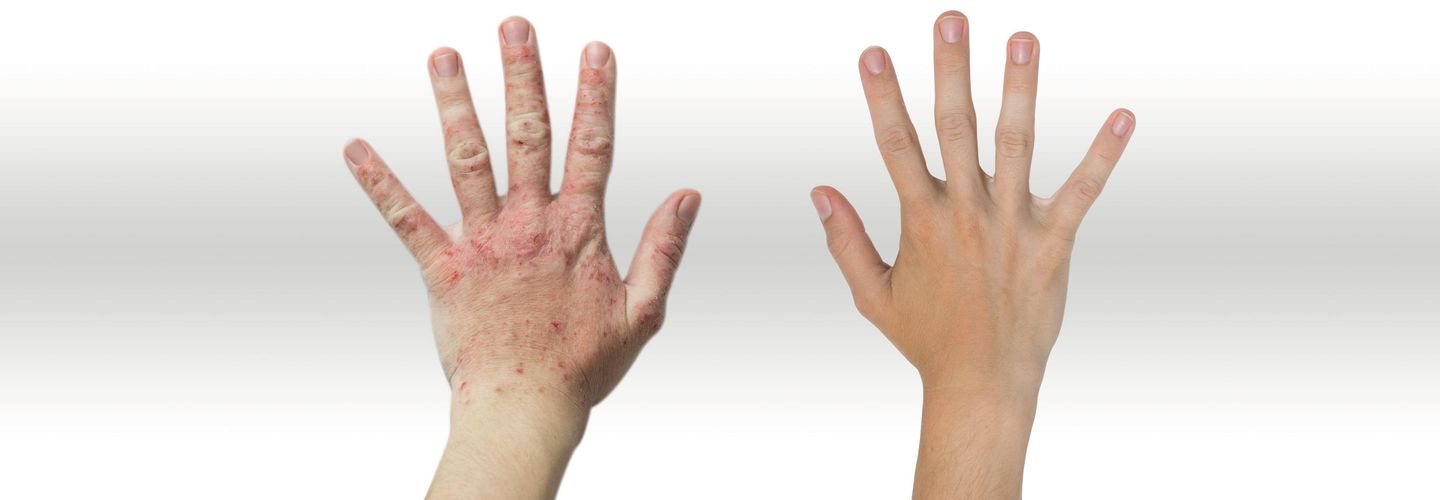headerbild_hautschutz_titel.tif