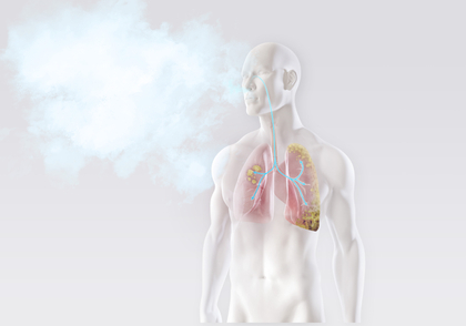 Krebs: Arbeitsplatzrisiken und Auswirkungen 