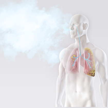 Cancer: risques liés au travail et répercussions
