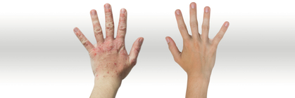 Protezione e cura della pelle anche sul lavoro!