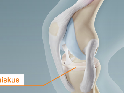 Les ménisques de l’articulation du genou et leur prise en compte par la médecine des assurances