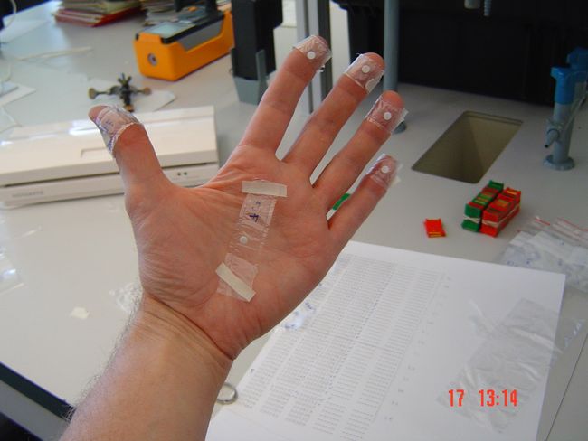 Chaque extrémité des doigts d’une main est dotée d’un petit dosimètre. Un dosimètre est également placé sur la paume de la main.