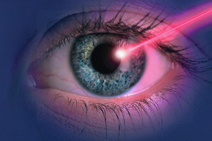 Attention: rayonnement laser! Utiliser les équipements laser en toute sécurité