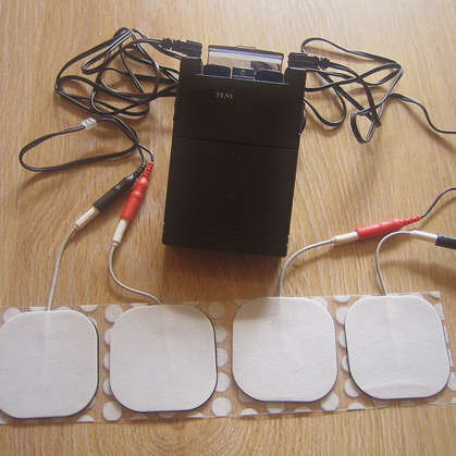 Cost assumption decision: the evidence-to-decision framework, using the example of TENS