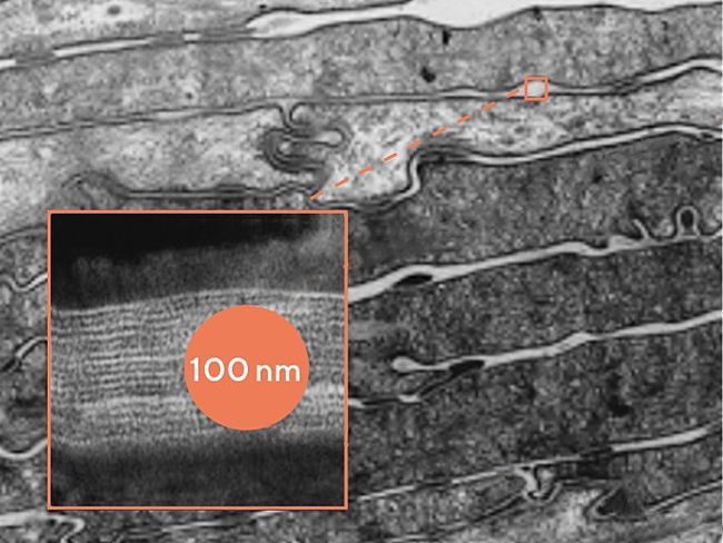 Ein Schnitt durch die Hornhaut zeigt Schichten in verschiedenen Grautönen. Ein Ausschnitt im dunkelgrauen Bereich zeigt, wie ein 100 nm-grosser, orange-farbiger Nanopartikel zwischen den einzelnen Schichten hängen bleibt. 