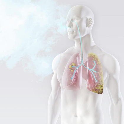 Amiante: interdiction d’inhaler