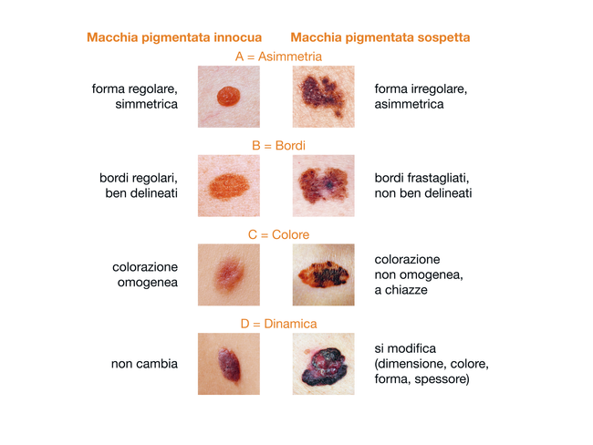 ABCD-Regel_i.eps