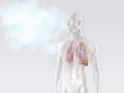 Cancro: rischi sul posto di lavoro e conseguenze