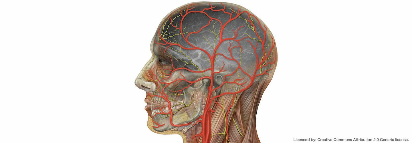 Human_with_external_and_internal_carotid_arteries.tif