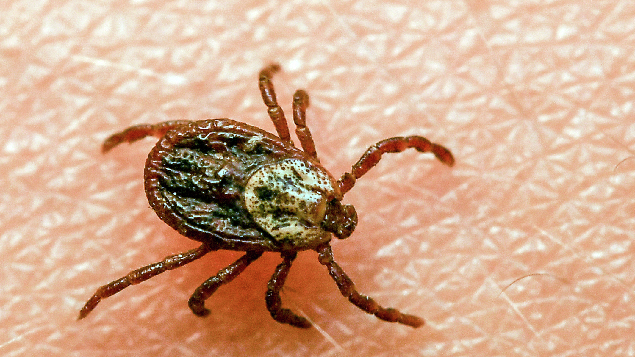 Tiques: comment échapper aux piqûres de tiques