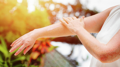 UV-Schutz: Schützen Sie die Haut vor dauerhaften Schäden